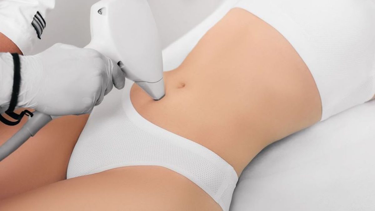 Laser Hair Removal procedure on woman's abdomen