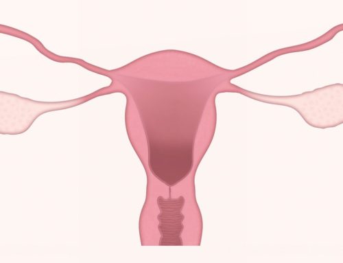 Helping Polycystic Ovary Syndrome